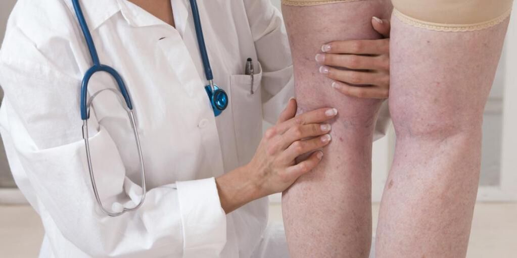 Doctorul examinează picioarele pacientului